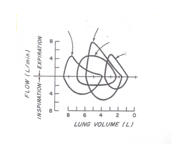 respiratory-flow-volume-loop-quiz