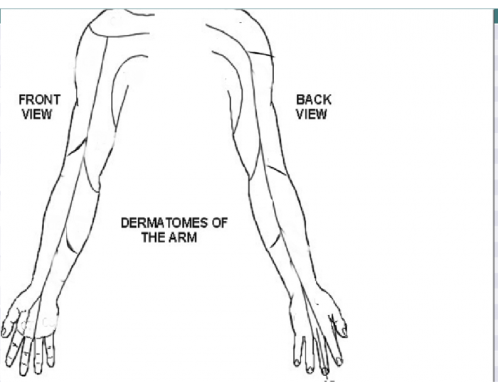dermatome arm