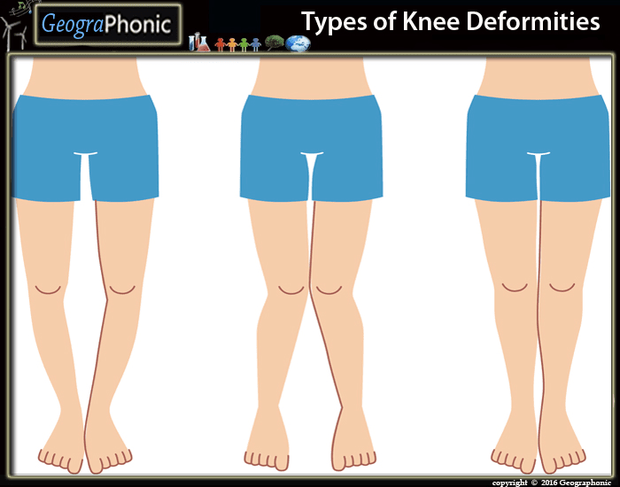 Types cheap of knees