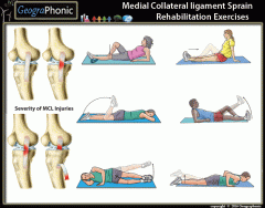 Medial Collateral Ligament Sprain Injury