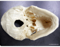 UT MAP Inferior skull