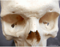 UT MAP Facial Bones