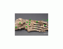 Label the bones of the foot and ankle