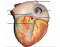 Heart Model 6