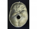 internal view of skull base