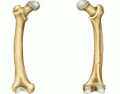 Femur Bone