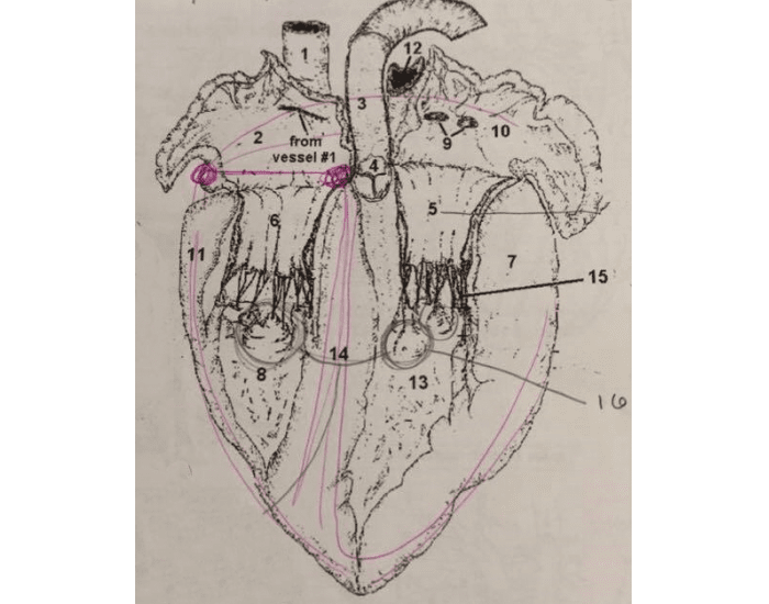 Label the Heart Anatomy Review Quiz