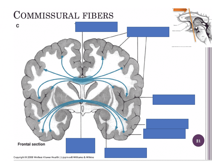 Commissural Fibers Quiz