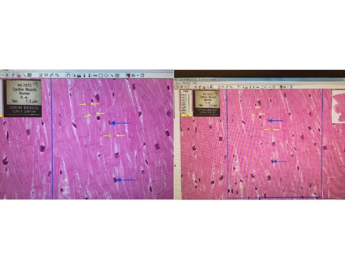 Cardiac Muscle Lab Bio.141 Lab.05 Cardiac muscle Quiz