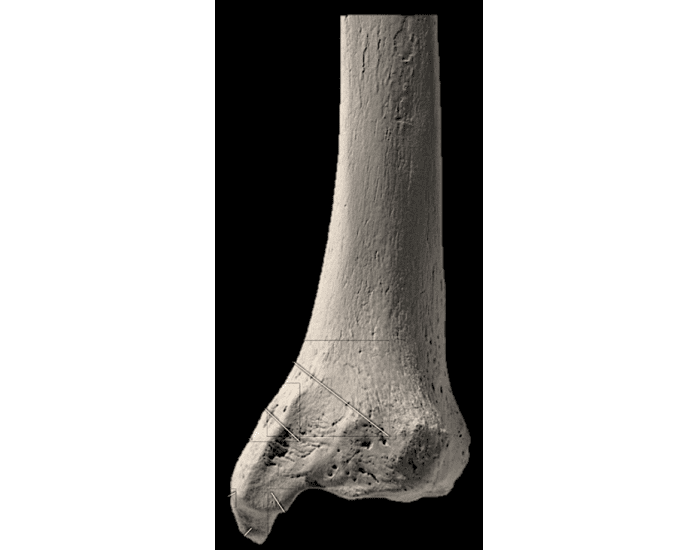 Tibia Distal View Tibia posterior/ distal view Quiz
