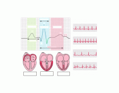 ECG - heart rhythms