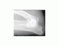Flexed mediolateral view of elbow x-ray