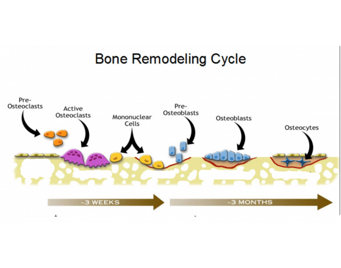 Bone Remodeling Quiz at Kellie Jackson blog