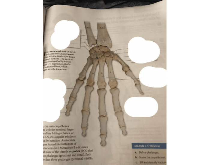 Right Risk Hand Right Wrist & Hand (Posterior View) Bones Quiz