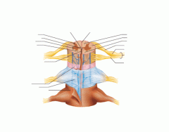 Anterior View of Meninges, Spinal Cord and Nerves