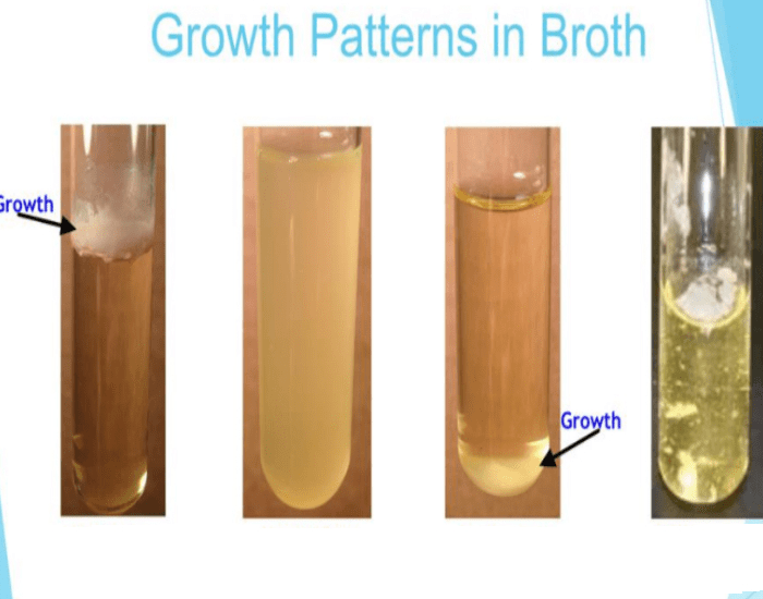 Micro: Broth Growth Quiz