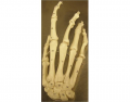 Bones of the hand (carpals)