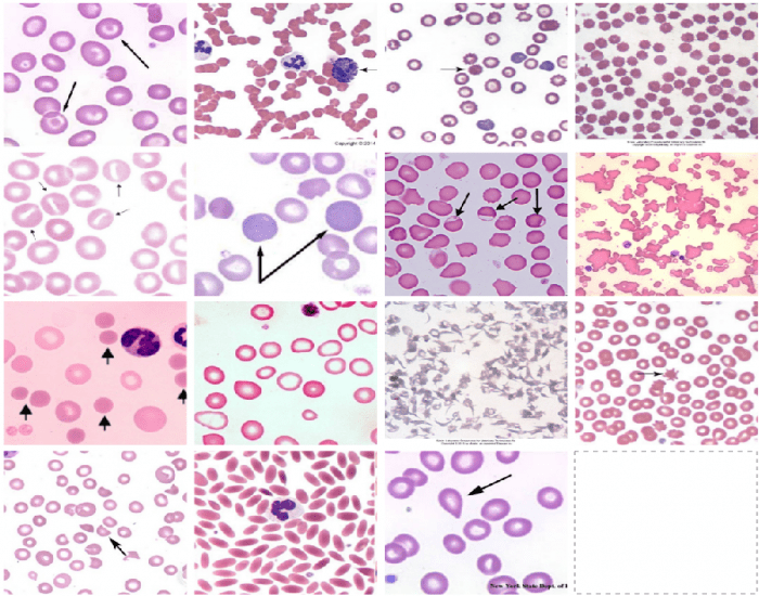 Normal Rbc Vet Med Veterinary RBC Morphology Quiz