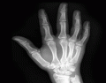 Wrist and Hand Bones