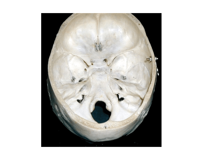 Bone Innerview Skull Internal View Bone Markings — Printable Worksheet