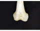Identify markings of the distal femur (anterior)