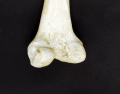 Identify markings of the posterior distal femur