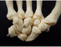 Carpel bones