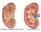 Gross Kidney Anatomy