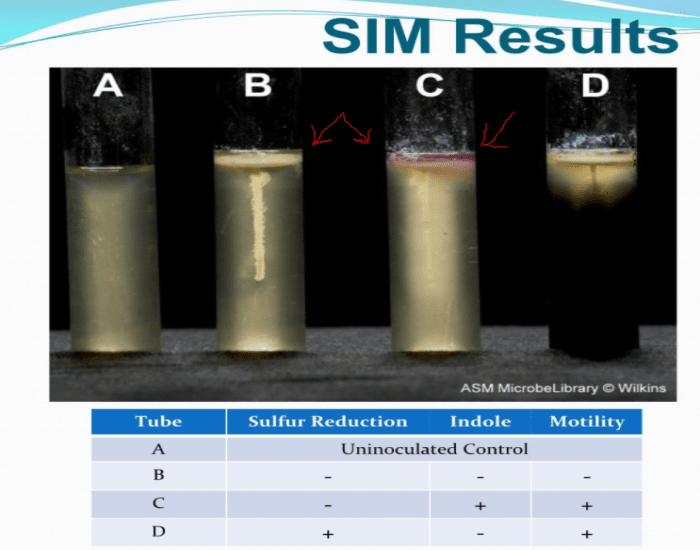 Sims Test Quiz