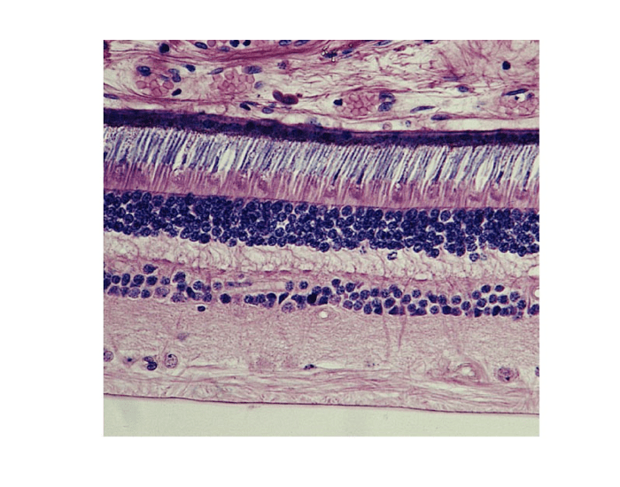 Pigmented Layer of Retina: Part 2 Quiz Pigmented Layer of Retina: Part 2 Quiz