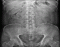 Abdomen X-ray Anatomy