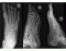 3-View Foot X-Ray Anatomy