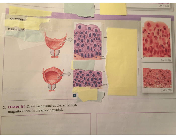 Label the transitional epithelium Quiz