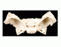 Superior View of Sphenoid bone