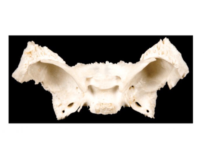 Sphenoid様専用猿頭蓋骨-