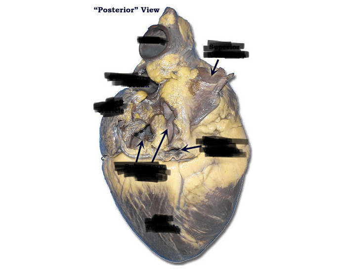 "posterior view" heart anatomy Quiz