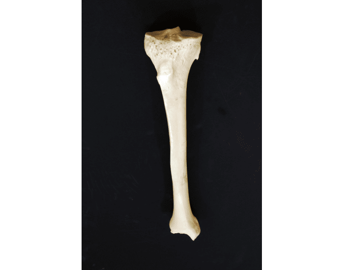Tibia Pieces Parts of the Tibia Quiz