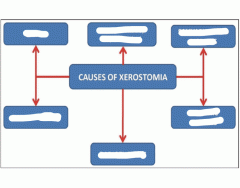 Causes of Xerostomia