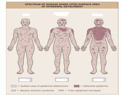 Surface area of disease