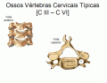 Vértebras cervicais típicas