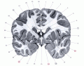 Coronal human Brain slice: genu internal-capsule