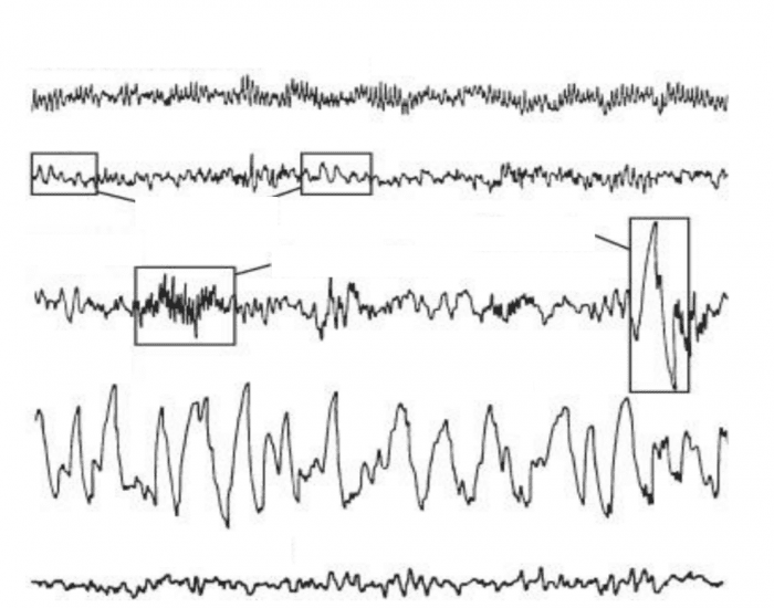 Sleep stage and wave labeling Quiz