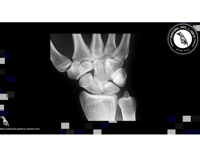 Pé - Anatomia Óssea Quiz