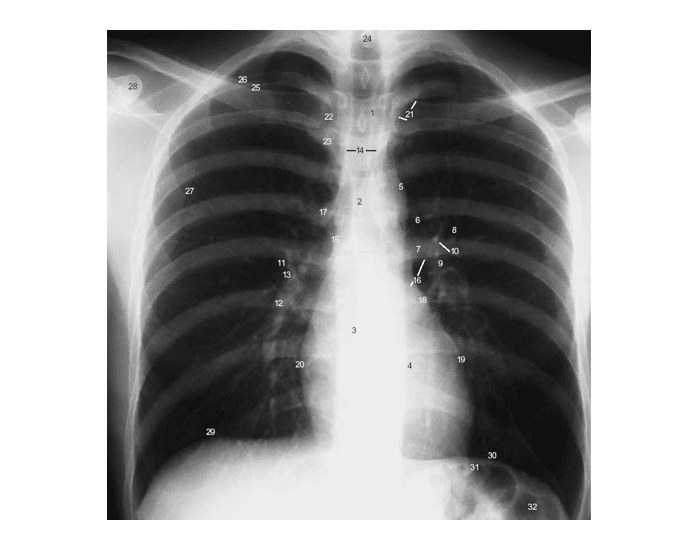 Bone Labelling Chest Label the chest anatomy Quiz