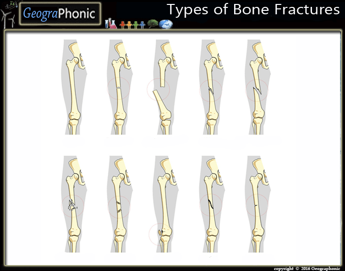 Bones Quizzes
