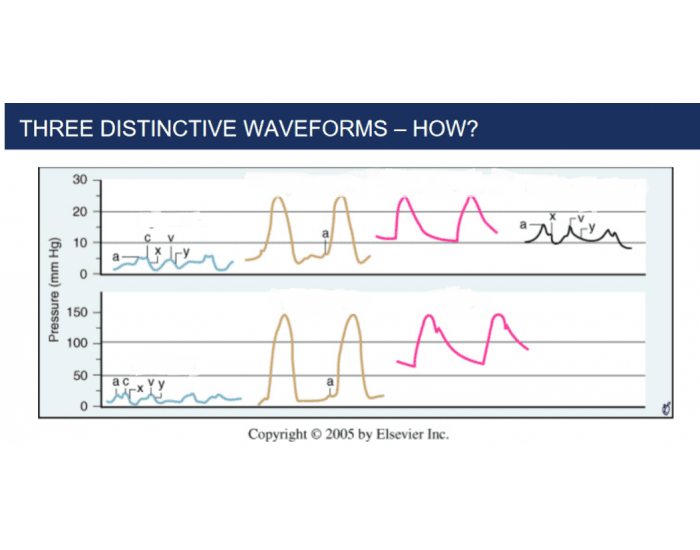 Wave Forms Quiz