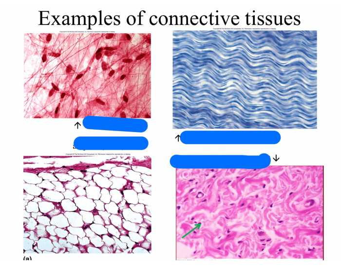 Match the types of connective tissues — Printable Worksheet