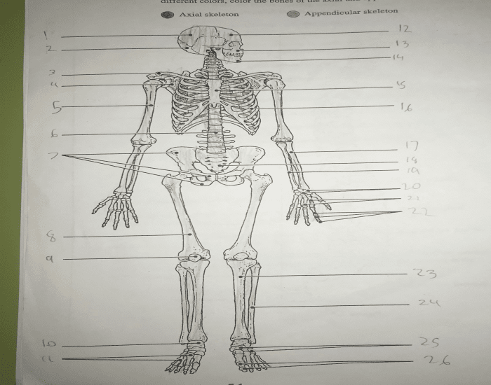 Anatomy-Bones Quiz
