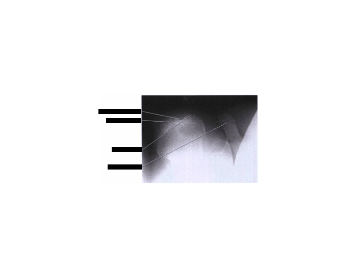 Fisk for Bicipital Groove Radiograph Quiz