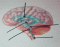Brain Ventricles (Lateral View)